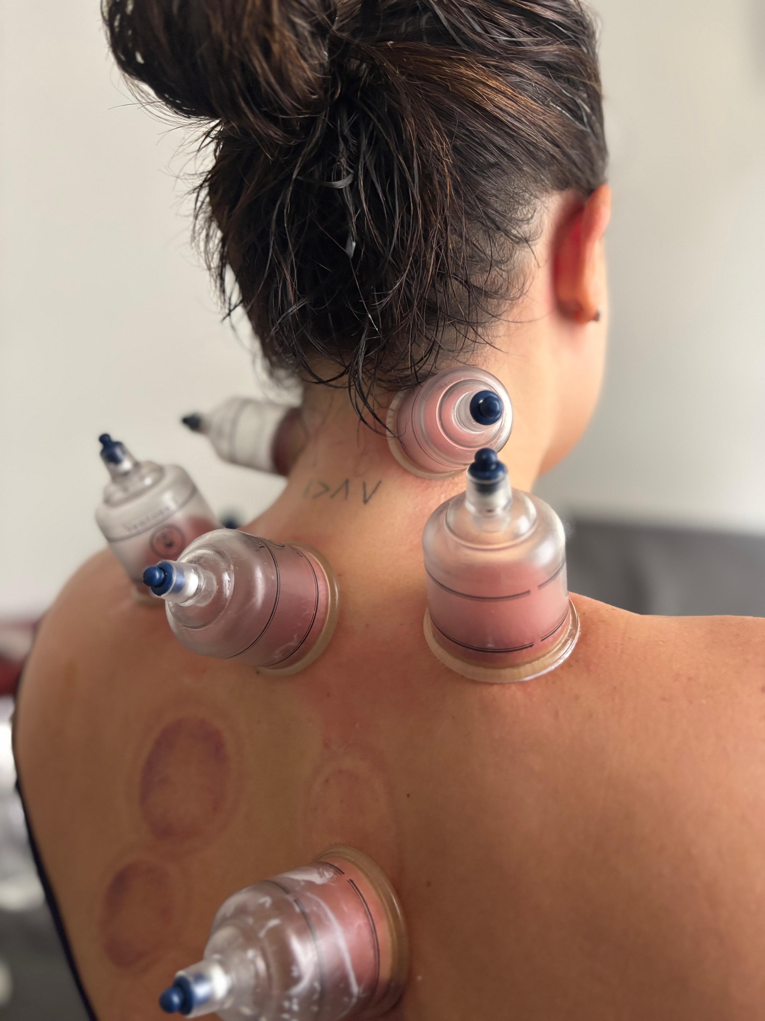 Liberação miofascial na região lombar